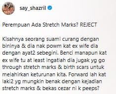 stretch mark hamil