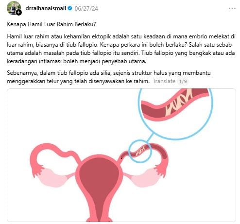 pembedahan luar rahim