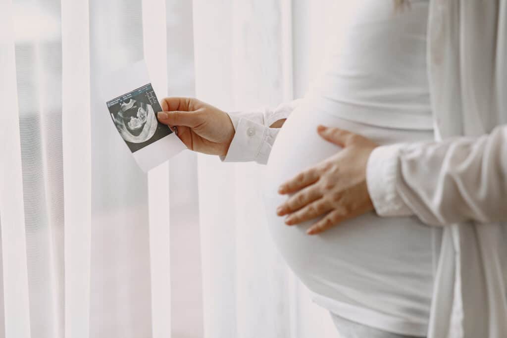 garis perut hamil anak perempuan