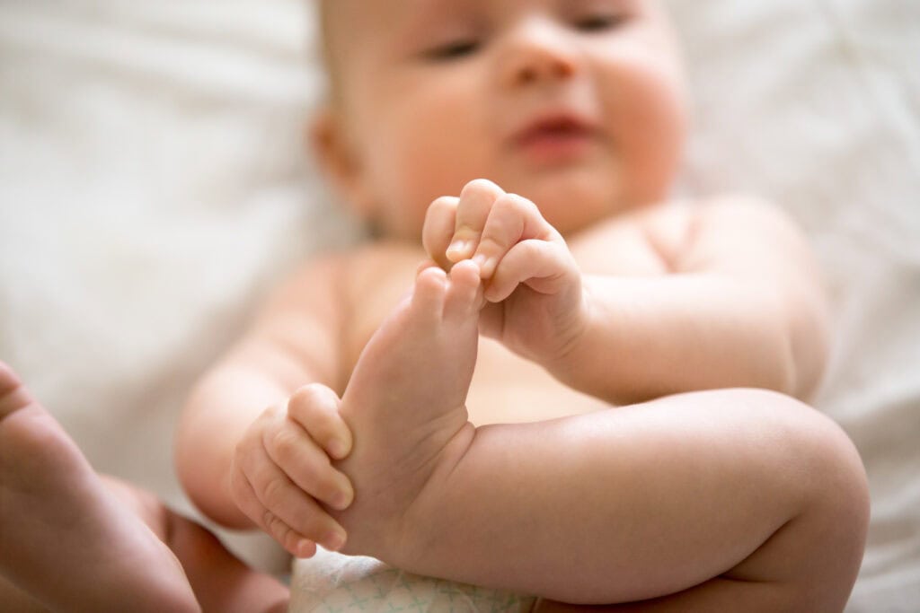 kulit bayi mengelupas